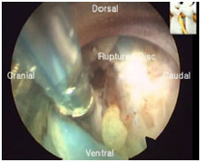 Endoscopic Spine Surgery